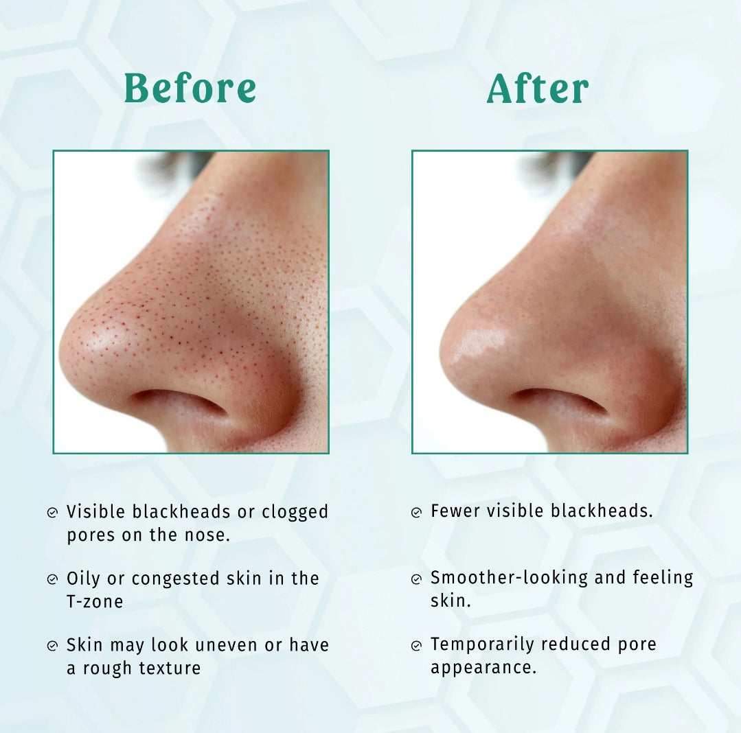Deep Cleansing Charcoal Nose Strips - Nose Blackheads & Pores Remover - Strip Talks