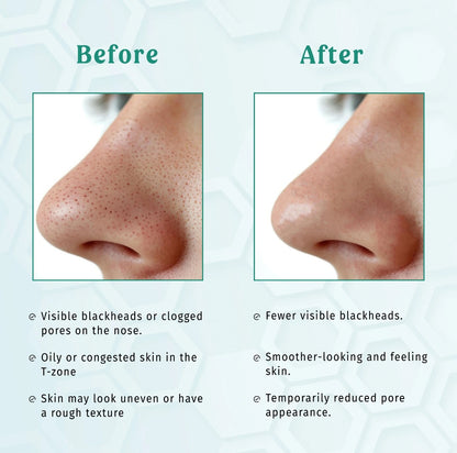 Deep Cleansing Charcoal Nose Strips - Nose Blackheads & Pores Remover - Strip Talks